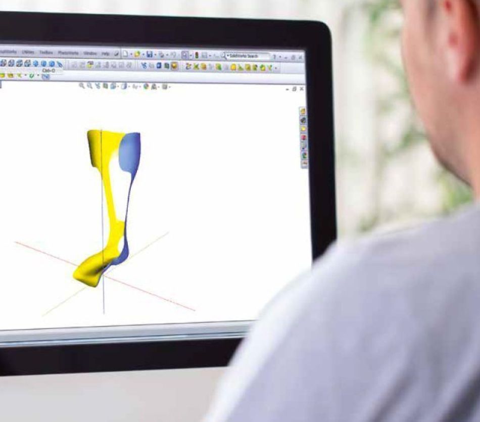 3D technieken binnen OIM Orthopedie