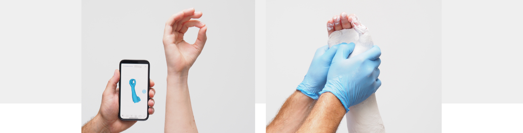 Onderzoek naar handorthesen - Amsterdam UMC