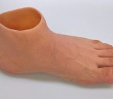 Een ander voorbeeld van een siliconen voetprothese.