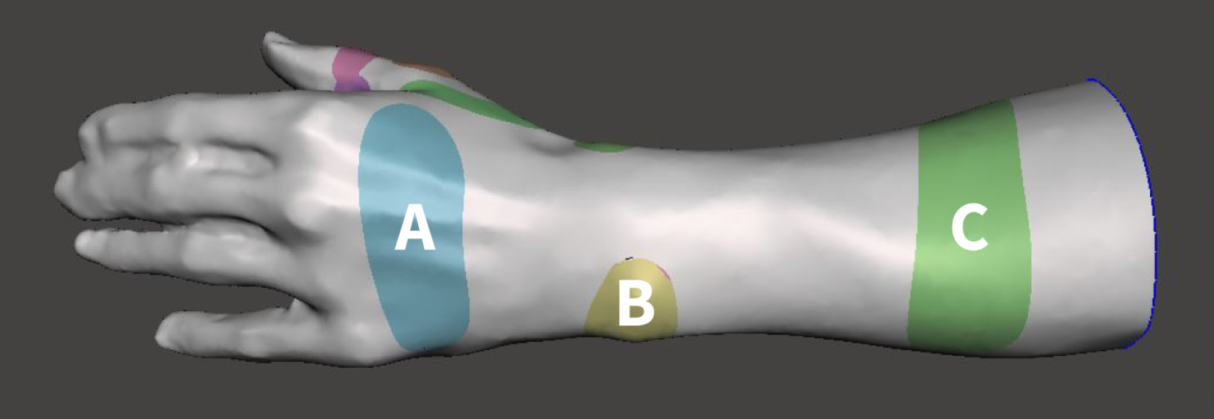 Evaluatie 3D handorthese